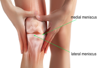 Meniscus repair surgery Bangalore